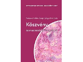 PROF.DR.SZEKANECZ ZOLTÁN - PROF.DR.PARAG: KÖSZVÉNY ÉS MÁS KRISTÁLYBETEGSÉGEK